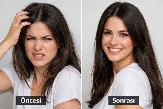 İnatçı Kepek İçin Doğal Çözüm: Çay Ağacı Yağı Maskesi (İlk Kullanımda Etki)